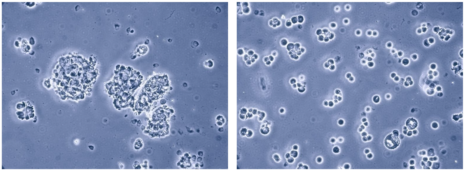 FACS max溶液解离后的MCF-7细胞