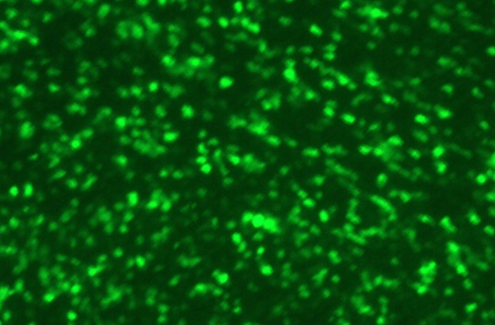 具有绿色荧光蛋白的人呼吸道合胞病毒 （RSV-GFP1）