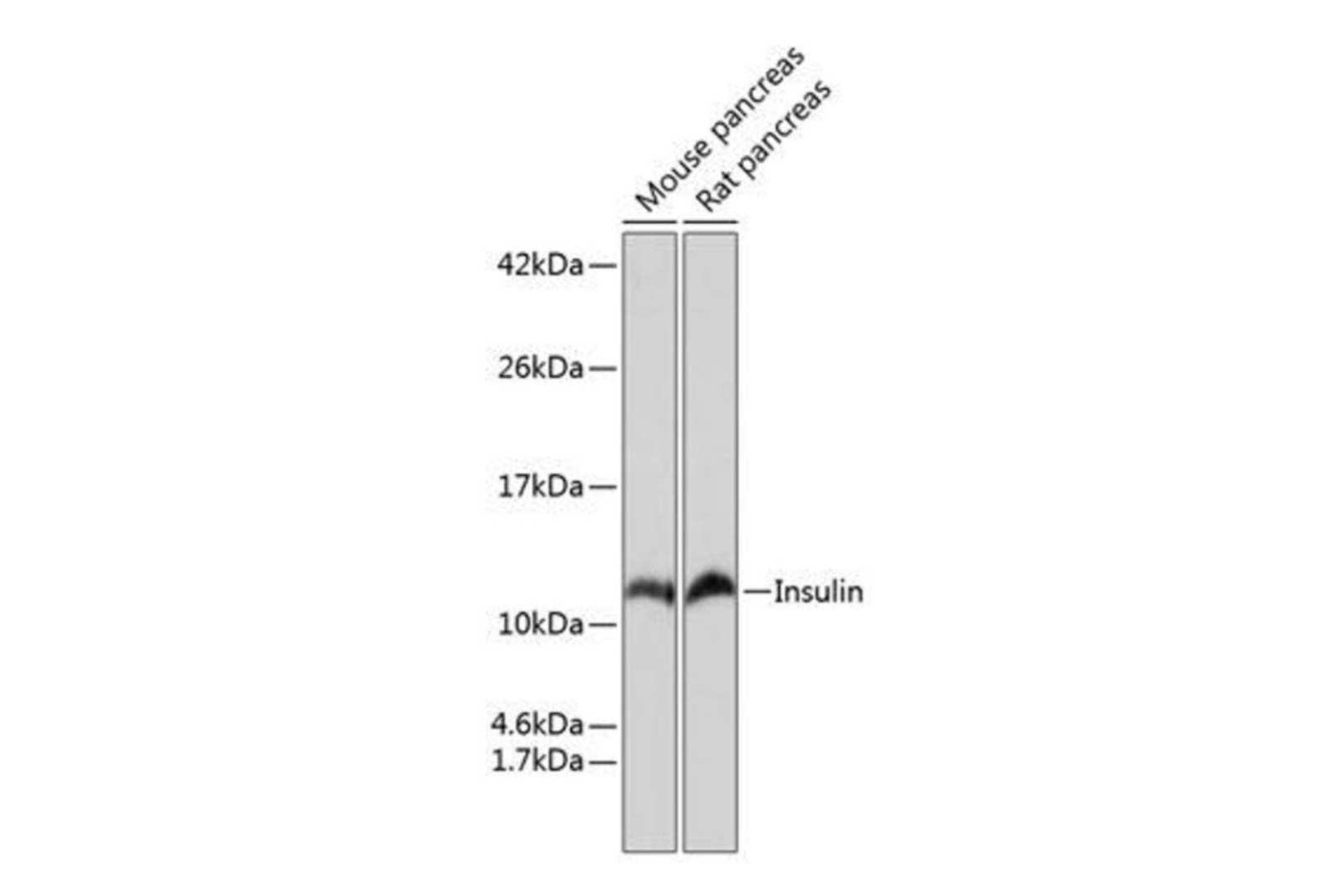 胰岛素单克隆抗体