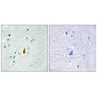 p53(phospho-Thr81)多克隆抗体